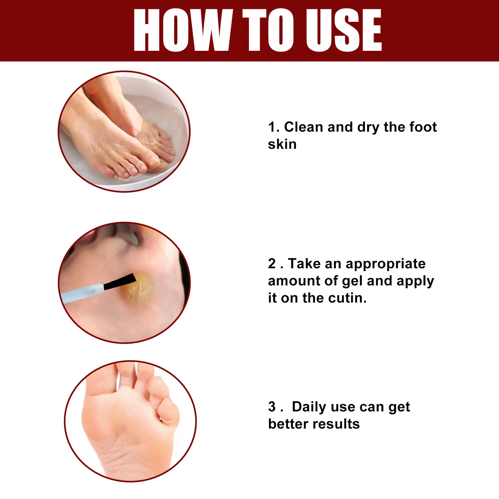 Foot Corn Removal Gel - অপারেশন ছাড়াই ব্যথামুক্ত সমাধান - Image 4
